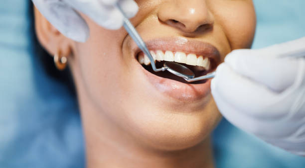 Best Weekend Emergency Dentist in Larkspur, CA