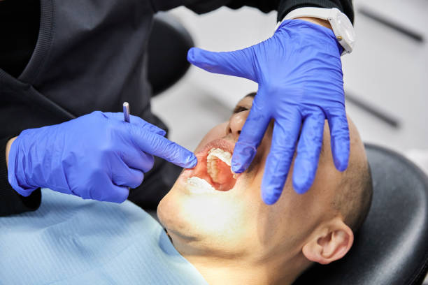 Best Emergency Tooth Extraction in Larkspur, CA