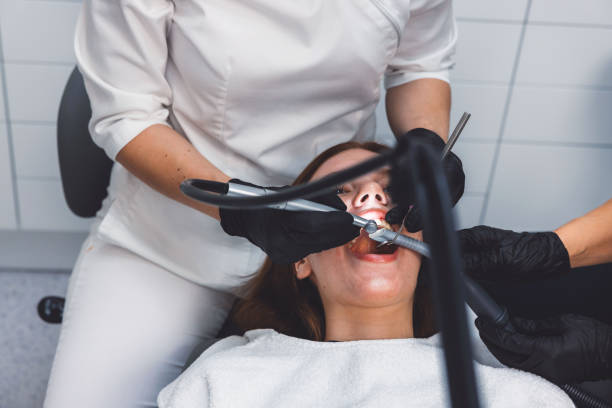 Best Emergency Wisdom Teeth Removal in Larkspur, CA