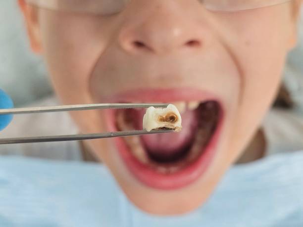 Best Same-Day Emergency Dentist in Larkspur, CA